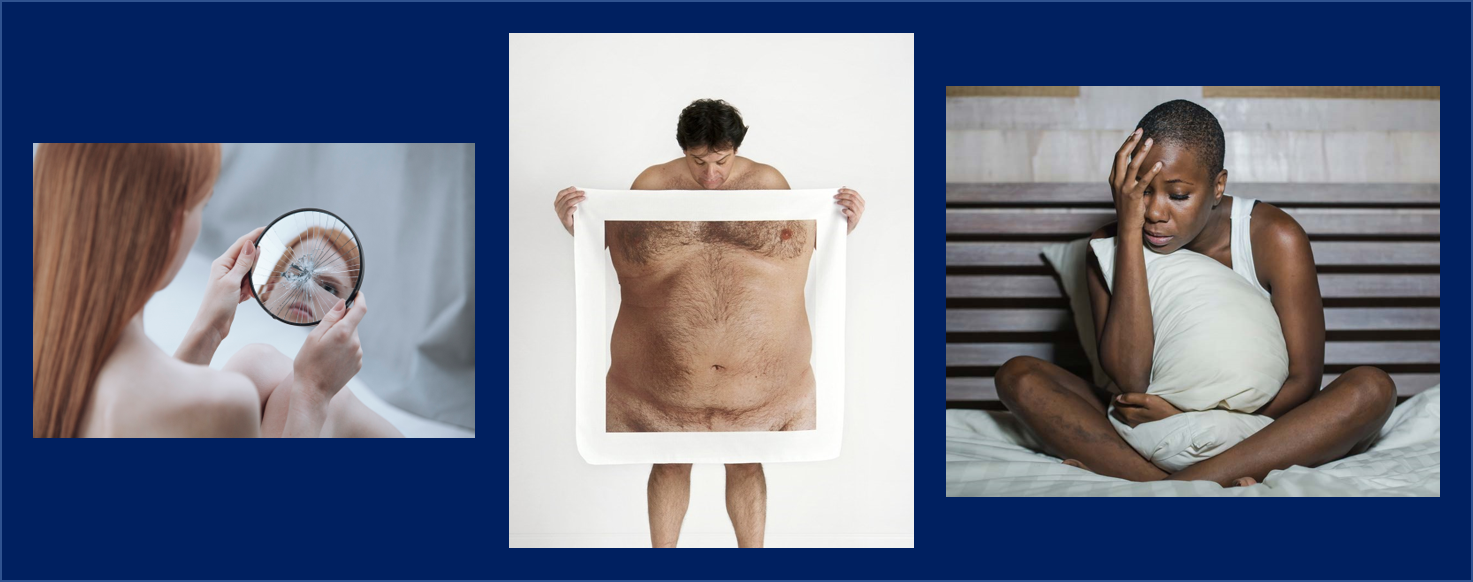 According to the Cleveland Clinic, 1 in 50 people within the U.S., or an estimated 5 million to 10 million, are affected by body dysmorphic disorder - a condition well known by those of us within OA.